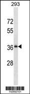 RALY RNA Binding Protein Like antibody, 60-880, ProSci, Western Blot image 