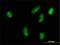 Ribosomal Protein S6 Kinase A2 antibody, H00006196-M01, Novus Biologicals, Immunofluorescence image 