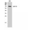 Zeta Chain Of T Cell Receptor Associated Protein Kinase 70 antibody, LS-C386743, Lifespan Biosciences, Western Blot image 