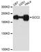 GRIP And Coiled-Coil Domain Containing 2 antibody, A07107, Boster Biological Technology, Western Blot image 