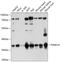 Proteasome 26S Subunit, Non-ATPase 14 antibody, GTX64996, GeneTex, Western Blot image 