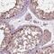 PEAK1 Related, Kinase-Activating Pseudokinase 1 antibody, PA5-52905, Invitrogen Antibodies, Immunohistochemistry frozen image 