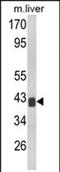 Transducer Of ERBB2, 1 antibody, PA5-72533, Invitrogen Antibodies, Western Blot image 