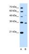 Sodium-coupled neutral amino acid transporter 3 antibody, NBP1-60103, Novus Biologicals, Western Blot image 
