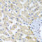 ATP Binding Cassette Subfamily B Member 8 antibody, LS-C408462, Lifespan Biosciences, Immunohistochemistry paraffin image 