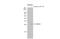 Suppressor of cytokine signaling 3 antibody, GTX104720, GeneTex, Western Blot image 