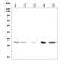 Solute Carrier Family 25 Member 1 antibody, A05995-1, Boster Biological Technology, Western Blot image 