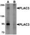 Pappalysin 2 antibody, A06838, Boster Biological Technology, Western Blot image 