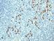 Immunoglobulin Lambda Variable 1-51 antibody, V3151IHC-7ML, NSJ Bioreagents, Immunohistochemistry paraffin image 