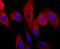 Parkin RBR E3 Ubiquitin Protein Ligase antibody, NBP2-67017, Novus Biologicals, Immunocytochemistry image 