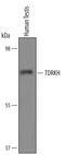 Tudor and KH domain-containing protein antibody, AF6286, R&D Systems, Western Blot image 