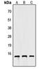 Apolipoprotein C4 antibody, GTX56082, GeneTex, Western Blot image 