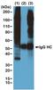 Phosphothreonine antibody, MA5-27976, Invitrogen Antibodies, Immunoprecipitation image 