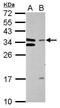 General Transcription Factor IIE Subunit 2 antibody, PA5-28923, Invitrogen Antibodies, Western Blot image 