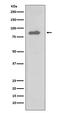 Component Of Inhibitor Of Nuclear Factor Kappa B Kinase Complex antibody, M01918-1, Boster Biological Technology, Western Blot image 