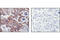 Eukaryotic Translation Initiation Factor 4 Gamma 1 antibody, 2498S, Cell Signaling Technology, Immunohistochemistry paraffin image 