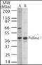 Pellino E3 Ubiquitin Protein Ligase 1 antibody, orb95353, Biorbyt, Western Blot image 