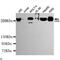 Chromodomain Helicase DNA Binding Protein 4 antibody, LS-C812919, Lifespan Biosciences, Western Blot image 