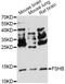 Follicle Stimulating Hormone Subunit Beta antibody, LS-C749532, Lifespan Biosciences, Western Blot image 