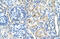 Signal peptide peptidase-like 2B antibody, 31-372, ProSci, Immunohistochemistry paraffin image 