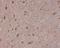 S100 Calcium Binding Protein B antibody, M00979-1, Boster Biological Technology, Immunohistochemistry frozen image 