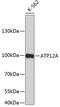 ATPase H+/K+ Transporting Non-Gastric Alpha2 Subunit antibody, 23-754, ProSci, Western Blot image 