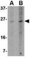 BCL2 Binding Component 3 antibody, GTX84989, GeneTex, Western Blot image 