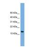 LSM8 Homolog, U6 Small Nuclear RNA Associated antibody, NBP1-57082, Novus Biologicals, Western Blot image 