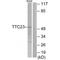 Tetratricopeptide Repeat Domain 23 antibody, A15453, Boster Biological Technology, Western Blot image 
