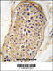 RPTOR Independent Companion Of MTOR Complex 2 antibody, 62-771, ProSci, Immunohistochemistry paraffin image 