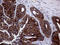 Argininosuccinate Synthase 1 antibody, LS-C791958, Lifespan Biosciences, Immunohistochemistry paraffin image 