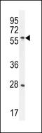 Delta Like Non-Canonical Notch Ligand 1 antibody, LS-C167437, Lifespan Biosciences, Western Blot image 