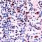 SRY-Box 2 antibody, MA5-16399, Invitrogen Antibodies, Immunohistochemistry paraffin image 