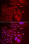 Trafficking Protein Particle Complex 10 antibody, LS-C334940, Lifespan Biosciences, Immunofluorescence image 