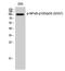 Nuclear Factor Kappa B Subunit 1 antibody, STJ90346, St John