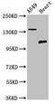 Adhesion G Protein-Coupled Receptor A2 antibody, CSB-PA857001LA01HU, Cusabio, Western Blot image 