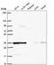 Deoxyribose-Phosphate Aldolase antibody, NBP2-58642, Novus Biologicals, Western Blot image 