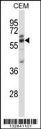 Coronin 2A antibody, 57-143, ProSci, Western Blot image 