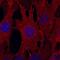 Endoglin antibody, MA5-23894, Invitrogen Antibodies, Immunocytochemistry image 
