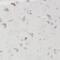 Calcium Homeostasis Endoplasmic Reticulum Protein antibody, FNab01647, FineTest, Immunohistochemistry frozen image 