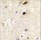 Phosphatidylinositol-4-Phosphate 5-Kinase Type 1 Beta antibody, LS-C101113, Lifespan Biosciences, Immunohistochemistry paraffin image 