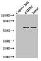 Prolyl 4-Hydroxylase Subunit Alpha 2 antibody, LS-C376260, Lifespan Biosciences, Immunoprecipitation image 