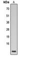 Phospholamban antibody, abx121458, Abbexa, Western Blot image 