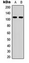EPH Receptor A6 antibody, orb256517, Biorbyt, Western Blot image 