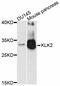 Kallikrein Related Peptidase 2 antibody, MBS127268, MyBioSource, Western Blot image 