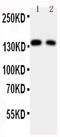 ADAM Metallopeptidase With Thrombospondin Type 1 Motif 2 antibody, PA5-78728, Invitrogen Antibodies, Western Blot image 