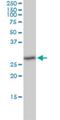 Thioredoxin Domain Containing 9 antibody, H00010190-M02, Novus Biologicals, Western Blot image 