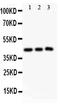 Sirtuin 2 antibody, LS-C344019, Lifespan Biosciences, Western Blot image 