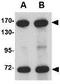 Nucleoporin 160 antibody, GTX31354, GeneTex, Western Blot image 