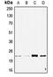 Stathmin 2 antibody, orb215038, Biorbyt, Western Blot image 